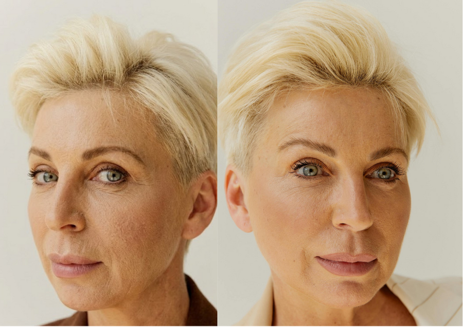 Textured skin without makeup
